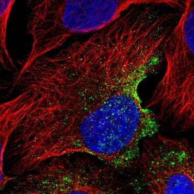 Immunocytochemistry/Immunofluorescence: EPS8L3 Antibody [NBP2-13966] - Immunofluorescent staining of human cell line U-2 OS shows localization to vesicles.