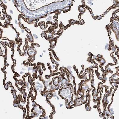 Immunohistochemistry-Paraffin: EPS8L3 Antibody [NBP2-13966] - Staining of human lung shows strong membranous positivity in alveolar and endothelial cells.