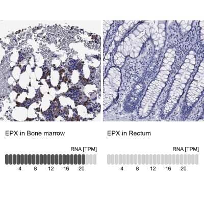 Immunohistochemistry-Paraffin: EPX Antibody [NBP3-17016] - Analysis in human bone marrow and rectum tissues using Anti-EPX antibody. Corresponding EPX RNA-seq data are presented for the same tissues.