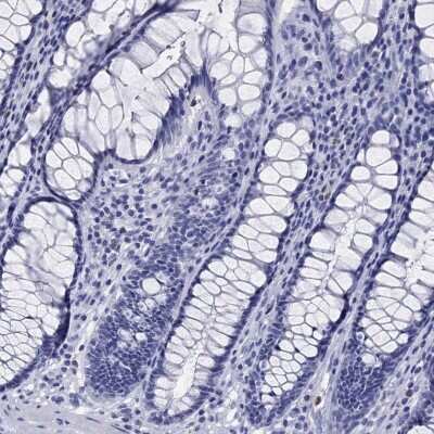 Immunohistochemistry-Paraffin: EPX Antibody [NBP3-17016] - Staining of human rectum shows low expression as expected.