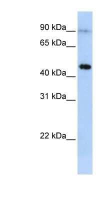 Western Blot: EPX Antibody [NBP1-58010] - MCF-7 whole cell lysates, concentration 0.2-1 ug/ml.