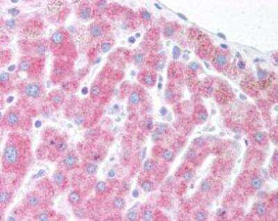 Immunohistochemistry: ER Associated Degradation Antibody Pack 3vials [NBP1-78944] - IHC staining of Derlin 1 in human liver using NB100-448.