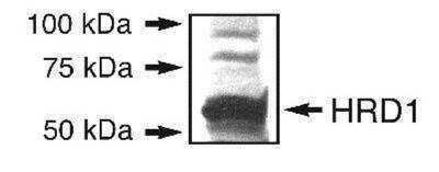 Western Blot: ER Associated Degradation Antibody Pack 3vials [NBP1-78944] - Western blot detection of HRD1 in an endogenous 293T cell lysate using NB100-2525.