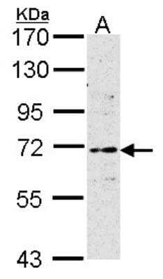 Western Blot: ER alpha/NR3A1 Antibody (1F3) [NBP1-41192] - Sample (30 ug of whole cell lysate) A: MCF7 7. 5% SDS PAGE, antibody diluted at 1:500.