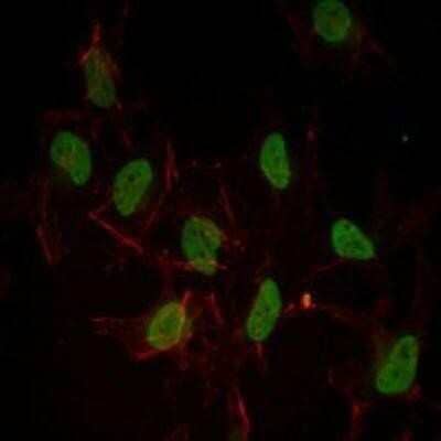 Immunocytochemistry/Immunofluorescence: ER alpha/NR3A1 Antibody (6B6) [NBP1-51653] - Immunofluorescence analysis of Hela cells using ESR1 mouse mAb (green). Red: Actin filaments have been labeled with Alexa Fluor-555 phalloidin.