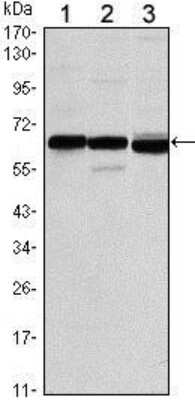 Western Blot: ER alpha/NR3A1 Antibody (6B6) [NBP1-51653] - Western blot analysis using ESR1 mouse mAb against MCF-7 (1), T47D (2) and SKBR3 (3) cell lysate.