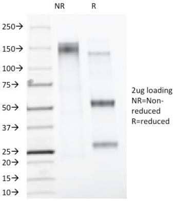 Western Blot: ER alpha/NR3A1 Antibody (AER314) - Azide and BSA Free [NBP2-48012] - Western Blot: ER alpha/NR3A1 Antibody (AER314) [NBP2-45006]