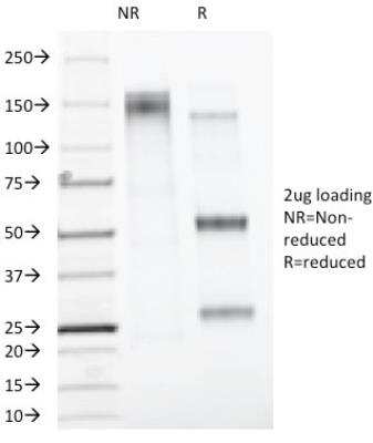 Western Blot: ER alpha/NR3A1 Antibody (AER314) [NBP2-45006]