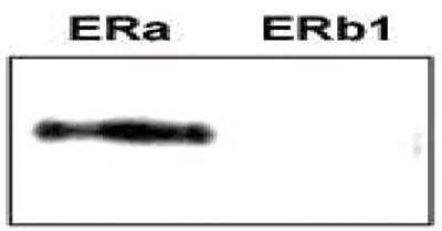 Western Blot: ER alpha/NR3A1 Antibody (C.15200009) [NBP2-59201] - Analysis was performed on 100 fmol ER alpha (ERa) and ER beta (ERb1) recombinant protein with the antibody directed against ER alpha at 7 ug/ mL. Figure shows the specificity of the antibody for the ER alpha isoform, whereas the ER beta isoform is not recognized.