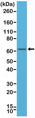 Western Blot: ER alpha/NR3A1 Antibody (RM292) [NBP2-61467] - Western Blot of MCF-7 cell lysates using NBP2-61467.