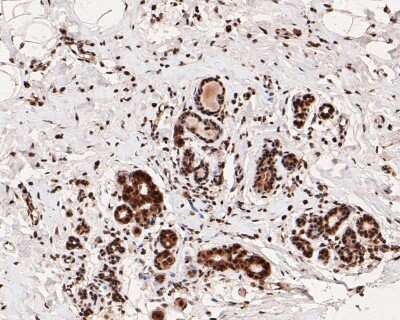Immunohistochemistry-Paraffin: ER alpha/NR3A1 [p Ser118] Antibody (SC05-87) [NBP2-67575] - Immunohistochemical analysis of paraffin-embedded human breast tissue using anti-ER alpha/NR3A1 antibody. The section was pre-treated using heat mediated antigen retrieval with Tris-EDTA buffer (pH 8.0-8.4) for 20 minutes. The tissues were blocked in 5% BSA for 30 minutes at room temperature, washed with ddH2O and PBS, and then probed with the primary antibody (ET1610-32, 1/50) for 30 minutes at room temperature. The detection was performed using an HRP conjugated compact polymer system. DAB was used as the chromogen. Tissues were counterstained with hematoxylin and mounted with DPX.