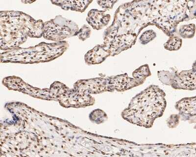 Immunohistochemistry-Paraffin: ER alpha/NR3A1 [p Ser118] Antibody (SC05-87) [NBP2-67575] - Immunohistochemical analysis of paraffin-embedded human placenta tissue using anti-ER alpha/NR3A1 antibody. The section was pre-treated using heat mediated antigen retrieval with Tris-EDTA buffer (pH 8.0-8.4) for 20 minutes. The tissues were blocked in 5% BSA for 30 minutes at room temperature, washed with ddH2O and PBS, and then probed with the primary antibody (ET1610-32, 1/50) for 30 minutes at room temperature. The detection was performed using an HRP conjugated compact polymer system. DAB was used as the chromogen. Tissues were counterstained with hematoxylin and mounted with DPX.