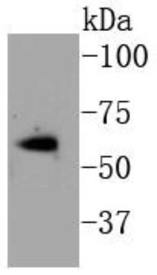 Western Blot: ER alpha/NR3A1 [p Ser118] Antibody (SC05-87) [NBP2-67575] - Analysis of Estrogen Receptor alpha(phospho S118) on MCF-7 cell lysates using anti- phospho-Estrogen Receptor alpha(S118) antibody at 1/1,000 dilution.