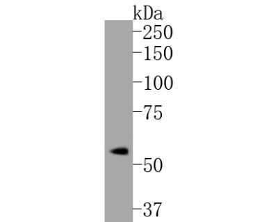 Western Blot: ER alpha/NR3A1 [p Ser118] Antibody (SC05-87) [NBP2-67575] - Western blot analysis of ER alpha/NR3A1 on MCF-7 cell lysates. Proteins were transferred to a PVDF membrane and blocked with 5% BSA in PBS for 1 hour at room temperature. The primary antibody (1/500) was used in 5% BSA at room temperature for 2 hours. Goa