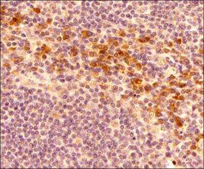Immunohistochemistry: ER associated Degradation Antibody Pack [NBP1-78944] - FFPE tissue section of human tonsil using rabbit polyclonal HRD1 antibody (NB100-2526) at 2 ug/mL concentration (1:500 dilution). The primary antibody binding to SYVN1/HRD1 antigen in cells was detected using HRP conjugated anti-Rabbit secondary antibody with DAB reagent, and the sections were further counterstained with hematoxylin for labeling cellular nuclei. This HRD1 antibody generated an expected cytoplasmic staining of HRD1 with stronger signal around periphery of the nucleus signifying the staining of the endoplasmic reticulum.