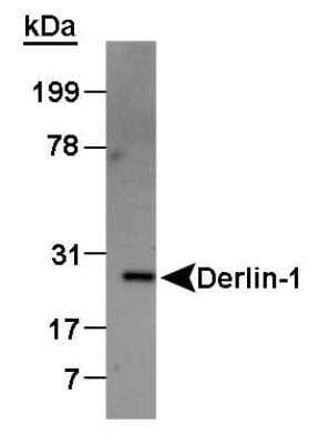 Western Blot: ER associated Degradation Antibody Pack [NBP1-78944] - Detection of Derlin protein in canine KRM microsomes using NB100-448