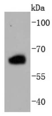 Western Blot: ER beta/NR3A2 Antibody (JJ09-02) [NBP2-67894] - Analysis of Estrogen Receptor beta on 293T cells lysates using anti-Estrogen Receptor beta antibody at 1/1,000 dilution.
