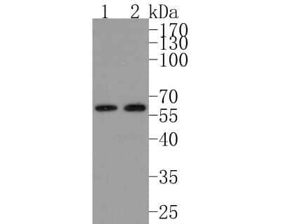 Western Blot: ER beta/NR3A2 Antibody (JJ09-02) [NBP2-67894] - Analysis of ER beta/NR3A2 on different lysates. Proteins were transferred to a PVDF membrane and blocked with 5% BSA in PBS for 1 hour at room temperature. The primary antibody (1/500) was used in 5% BSA at room temperature for 2 hours. Goat Anti-Rabbit IgG - HRP Secondary Antibody at 1:200,000 dilution was used for 1 hour at room temperature. Positive control: Lane 1: MCF-7 cell lysate Lane 2: Daudi cell lysate