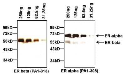 Western Blot: ER beta/NR3A2 Antibody [NB300-747] - Recombinant full-length human ER alpha & ER beta proteins, & 10ul of PageRuler Prestained Protein Ladder loaded onto a Novex 4-20% Tris-Glycine polyacrylamide gel. Transferred to PVDF membrane using G2 Blotter, & blocked with 5% milk in TBST for 1 hr at RT. ER beta at ~54kD (left) using ER beta pAb at 1:1000 in blocking buffer overnight at 4C on rocking platform, then HRP- goat anti-rabbit IgG secondary antibody at 1:40000. Chemiluminescent detection performed using SuperSignal West Pico. The blot stripped with Restore Plus Western blot stripping buffer for 15 min at room temp, re-blocked with 5% milk in TBST for 1 hr at room temp, & re-probed with an ER alpha pAb at a dilution of 1:2000 overnight at 4C, followed by an HRP-goat anti-rabbit IgG secondary antibody at a dilution of 1:40,000. Chemiluminescent detection was performed using SuperSignal West Pico. The presence of faint ER-beta b&s on the blot probed.