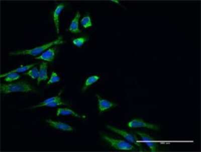 Immunocytochemistry/Immunofluorescence: ERAB Antibody [H00003028-D01P] - Analysis of antibody to HSD17B10 on HeLa cell. Antibody concentration 30 ug/ml.