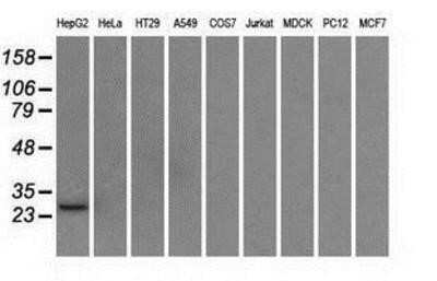 Western Blot: ERAB Antibody (OTI10B4) - Azide and BSA Free [NBP2-70871] - Analysis of extracts (35ug) from 9 different cell lines by using anti-ERAB monoclonal antibody.