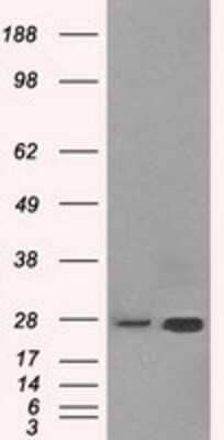 Western Blot: ERAB Antibody (OTI10B4) - Azide and BSA Free [NBP2-70871] - HEK293T cells were transfected with the pCMV6-ENTRY control (Left lane) or pCMV6-ENTRY ERAB (Right lane) cDNA for 48 hrs and lysed. Equivalent amounts of cell lysates (5 ug per lane) were separated by SDS-PAGE and immunoblotted with anti-ERAB.