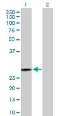 Western Blot: ERAB Antibody [H00003028-D01P] - Analysis of HSD17B10 expression in transfected 293T cell line by HSD17B10 polyclonal antibody.Lane 1: HSD17B10 transfected lysate(26.90 KDa).Lane 2: Non-transfected lysate.
