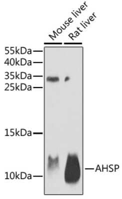 Western Blot: ERAF Antibody [NBP3-03222] - Analysis of extracts of various cell lines, using ERAF antibody at 1:1000 dilution. Secondary antibody: HRP Goat Anti-Rabbit IgG (H+L) at 1:10000 dilution. Lysates/proteins: 25ug per lane. Blocking buffer: 3% nonfat dry milk in TBST. Detection: ECL Basic Kit.