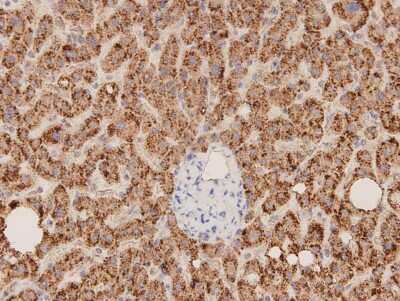 Immunohistochemistry-Paraffin: ERAS Antibody (D10-B9) [NBP2-66822] - Analysis of paraffin-embedded human liver carcinoma tissue using anti- ERAS Mouse mAb.
