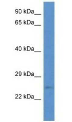 Western Blot: ERAS Antibody [NBP1-79602] - Mouse Heart Lysate 1ug/ml  Gel Concentration 12%