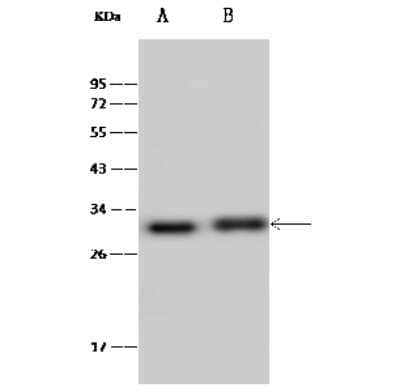 Western Blot: ERAS Antibody [NBP2-99426] - Anti-ERAS rabbit polyclonal antibody at 1:500 dilution. Lane A: HeLa Whole Cell Lysate Lane B: Mouse Lung tissue lysate Lysates/proteins at 30 ug per lane. Secondary Goat Anti-Rabbit IgG (H+L)/HRP at 1/10000 dilution. Developed using the ECL technique. Performed under reducing conditions. Predicted band size: 25 kDa. Observed band size: 28 kDa