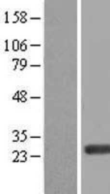 Western Blot: ERAS Overexpression Lysate (Adult Normal) [NBL1-10313] Left-Empty vector transfected control cell lysate (HEK293 cell lysate); Right -Over-expression Lysate for ERAS.