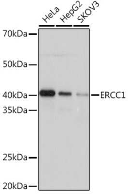Western Blot: ERCC1 Antibody (5F9U0) [NBP3-16521] - Western blot analysis of extracts of various cell lines, using ERCC1 Rabbit mAb (NBP3-16521) at 1:1000 dilution. Secondary antibody: HRP Goat Anti-Rabbit IgG (H+L) at 1:10000 dilution. Lysates/proteins: 25ug per lane. Blocking buffer: 3% nonfat dry milk in TBST. Detection: ECL Basic Kit. Exposure time: 3s.