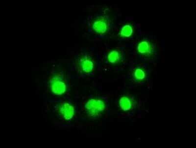 Immunocytochemistry/Immunofluorescence: ERCC1 Antibody (OTI1A3) - Azide and BSA Free [NBP2-70662] - Staining of COS7 cells transiently transfected by pCMV6-ENTRY ERCC1.