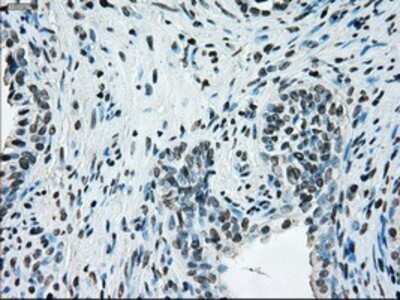 Immunohistochemistry: ERCC1 Antibody (OTI1A3) - Azide and BSA Free [NBP2-70662] - Staining of paraffin-embedded prostate tissue using anti-ERCC1 mouse monoclonal antibody.