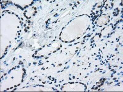 Immunohistochemistry: ERCC1 Antibody (OTI1A3) - Azide and BSA Free [NBP2-70662] - Staining of paraffin-embedded thyroid tissue using anti-ERCC1 mouse monoclonal antibody.