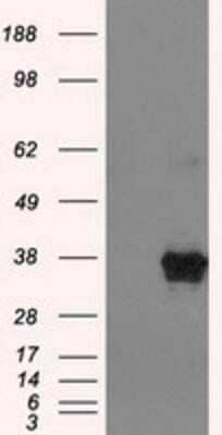 Western Blot: ERCC1 Antibody (OTI1A3) - Azide and BSA Free [NBP2-70662] - HEK293T cells were transfected with the pCMV6-ENTRY control (Left lane) or pCMV6-ENTRY ERCC1(Right lane) cDNA for 48 hrs and lysed. Equivalent amounts of cell lysates (5 ug per lane) were separated by SDS-PAGE and immunoblotted with anti-ERCC1.