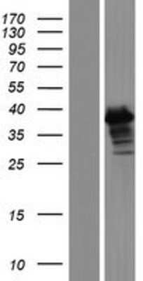 Western Blot: ERCC1 Overexpression Lysate (Adult Normal) [NBL1-10319] Left-Empty vector transfected control cell lysate (HEK293 cell lysate); Right -Over-expression Lysate for ERCC1.