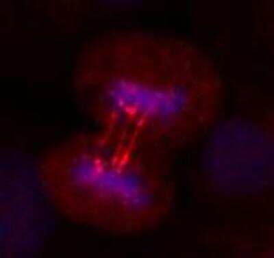 Immunocytochemistry/ Immunofluorescence ERCC6L Antibody