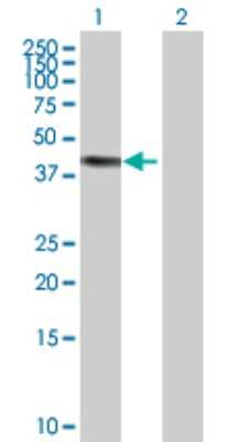 Western Blot: ERCC8 Antibody [H00001161-D01P] - Analysis of ERCC8 expression in transfected 293T cell line by ERCC8 polyclonal antibody.Lane 1: ERCC8 transfected lysate(44.10 KDa).Lane 2: Non-transfected lysate.