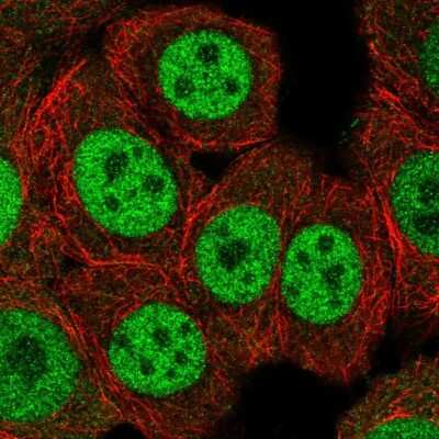 Immunocytochemistry/Immunofluorescence: ERF Antibody [NBP2-49538] - Staining of human cell line MCF7 shows localization to nucleoplasm.