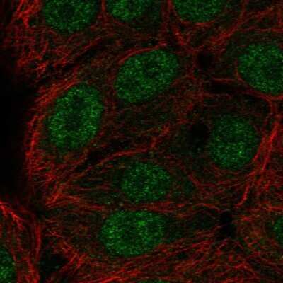 Immunocytochemistry/Immunofluorescence: ERF Antibody [NBP2-56079] - Staining of human cell line MCF7 shows localization to nucleoplasm.