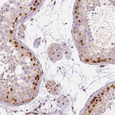 Immunohistochemistry-Paraffin: ERF Antibody [NBP2-49538] - Staining of human testis shows strong nuclear positivity in subset of cells in seminiferous ducts.