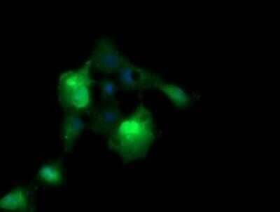 Immunocytochemistry/Immunofluorescence: ERG Antibody (OTI4H7) - Azide and BSA Free [NBP2-70686] - Analysis of COS7 cells transiently transfected by pCMV6-ENTRY ERG.