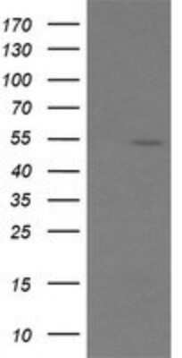 Western Blot: ERG Antibody (OTI4H7) - Azide and BSA Free [NBP2-70686] - Analysis of HEK293T cells were transfected with the pCMV6-ENTRY control (Left lane) or pCMV6-ENTRY ERG.