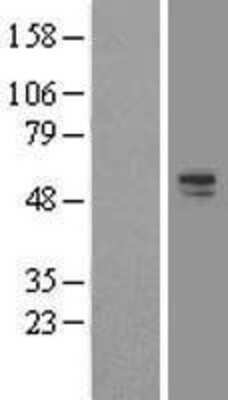 Western Blot: ERG Overexpression Lysate (Adult Normal) [NBL1-10327] Left-Empty vector transfected control cell lysate (HEK293 cell lysate); Right -Over-expression Lysate for ERG.