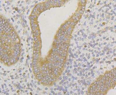 Immunohistochemistry: ERGI3 Antibody [NBP2-76928] - Immunohistochemical analysis of paraffin-embedded human uterus tissue using anti-ERGI3 antibody. Counter stained with hematoxylin.