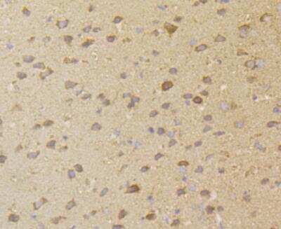 Immunohistochemistry: ERGI3 Antibody [NBP2-76928] - Immunohistochemical analysis of paraffin-embedded mouse brain tissue using anti-ERGI3 antibody. Counter stained with hematoxylin.