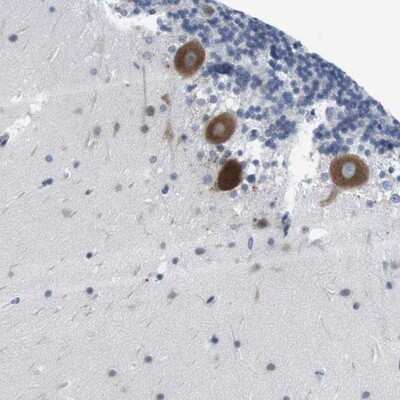 Immunohistochemistry-Paraffin: ERGI3 Antibody [NBP1-89882] - Staining of human cerebellum shows strong cytoplasmic positivity in purkinje cells.