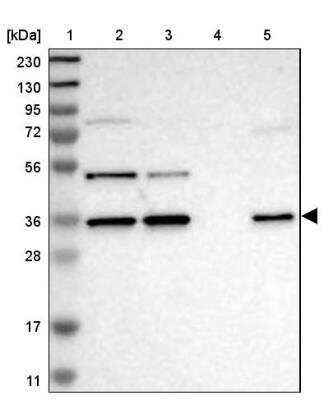 Western Blot: ERGI3 Antibody [NBP1-89881] - Lane 1: Marker  [kDa] 230, 130, 95, 72, 56, 36, 28, 17, 11.  Lane 2: Human cell line RT-4.  Lane 3: Human cell line U-251MG sp.  Lane 4: Human plasma (IgG/HSA depleted).  Lane 5: Human liver tissue